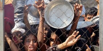 Gaza Malnourished children