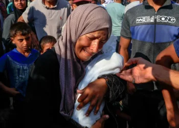 Gaza Malnourished children