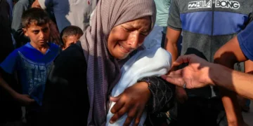 21 Children Die of Malnutrition in Gaza Hospitals Amid Israeli Blockade and Strikes Gaza Malnourished children