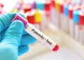 DNA Testing Kit