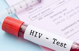 Africa Begins First Public Rollout of Revolutionary HIV Prevention Injection HIV-AIDS
