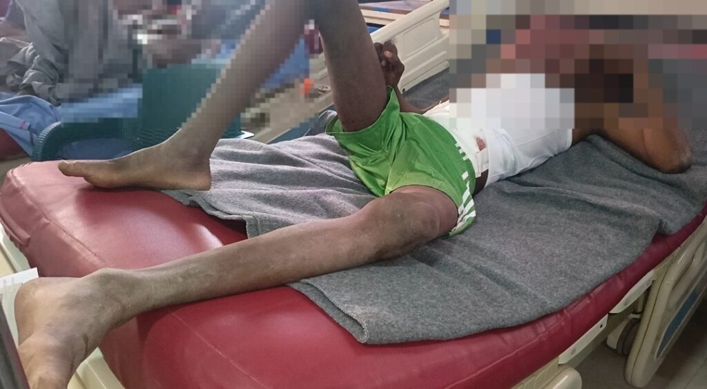 Blood Shortage Hits Maiduguri Hospital After Airstrike Victims in Borno state Specialist Hospital